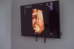 echographie-3D-4D